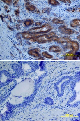 ADAM15 antibody in Human Prostate by Immunohistochemistry (IHC-P).
