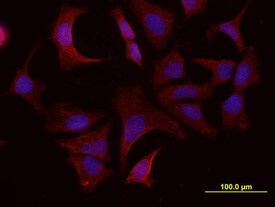 ADAM15 antibody in MCF-7 Human Cell Line by Immunocytochemistry (ICC).