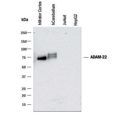 Detection of Human ADAM22 antibody by Western Blot.