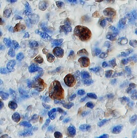 ADAM23 antibody in Human Spleen by Immunohistochemistry (IHC-P).