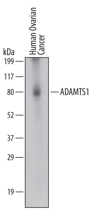 Detection of Human ADAMTS1 antibody by Western Blot.