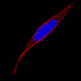 ADAMTS4 antibody in SH-SY5Y Human Cell Line by Immunocytochemistry (ICC).
