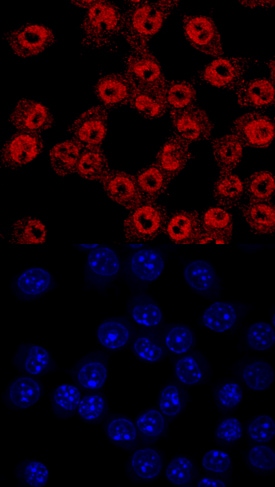 ADNP antibody in RAW 264 by Immunocytochemistry (ICC).7 Mouse Cell Line by Immunocytochemistry (ICC).
