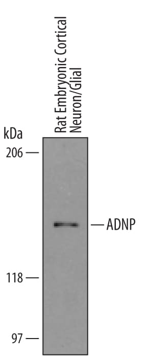 Detection of Mouse/Rat ADNP antibody by Western Blot.