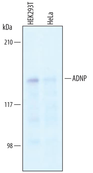 Detection of Human ADNP antibody by Western Blot.