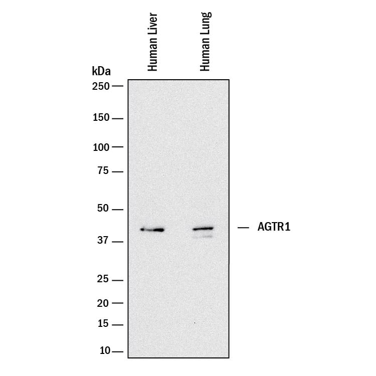 Detection of Human AGTR-1 antibody by Western Blot.