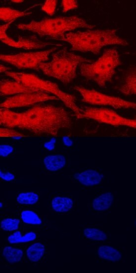 AHR antibody in HeLa Human Cell Line by Immunocytochemistry (ICC).