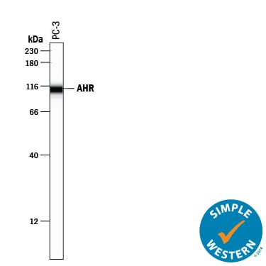 Detection of Human AHR antibody by Simple WesternTM.