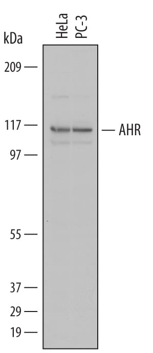 Detection of Human AHR antibody by Western Blot.