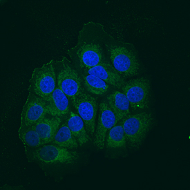 AIF antibody in MCF-7 Human Cell Line by Immunocytochemistry (ICC).