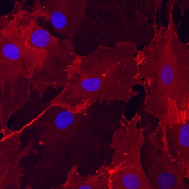 ALCAM/CD166 antibody in Rat Mesenchymal Stem Cells by Immunocytochemistry (ICC).