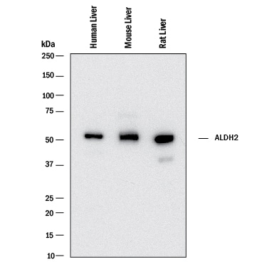 Detection of Human. Mouse, and Rat ALDH2 antibody by Western Blot.
