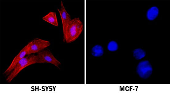 ALK/CD246 antibody in SH-SY5Y Human Cell Line by Immunocytochemistry (ICC).