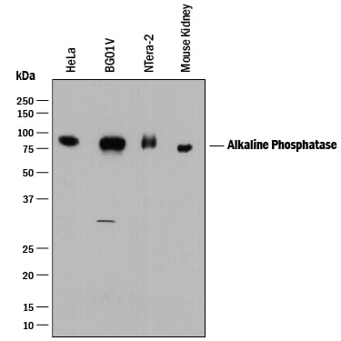 Detection of Human and Mouse Alkaline Phosphatase/ALPL antibody by Western Blot.