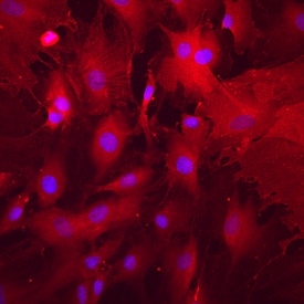 Alkaline Phosphatase/ALPL antibody in Rat Mesenchymal Stem Cells by Immunocytochemistry (ICC).