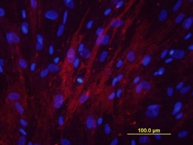 Alkaline Phosphatase/ALPL antibody in Human Osteoblasts by Immunocytochemistry (ICC).