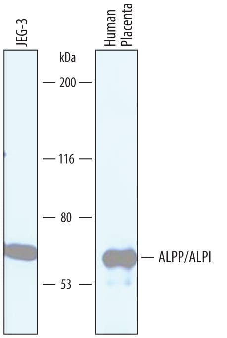 Detection of Human Alkaline Phosphatase/ALPP/ALPI antibody by Western Blot.