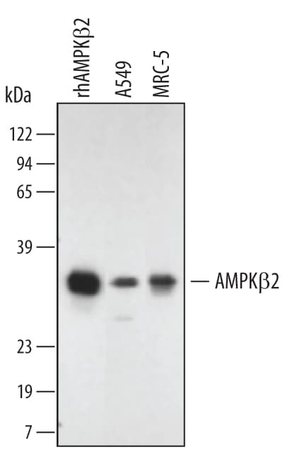 Detection of Human/Mouse AMPK beta 2 antibody by Western Blot.