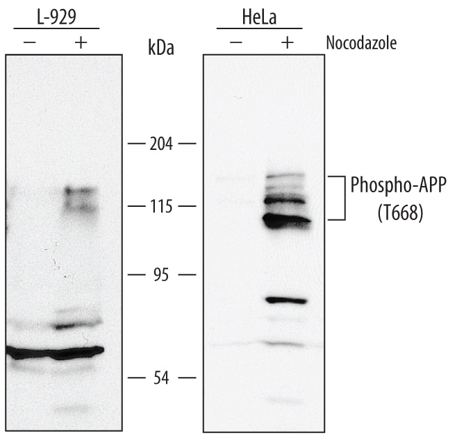 Detection of Human and Mouse Phospho-APP/Protease Nexin II (T668) antibody by Western Blot.