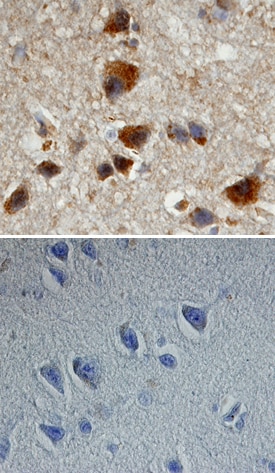 APP/Protease Nexin II antibody in Human Alzheimer's Disease Brain by Immunohistochemistry (IHC-P).