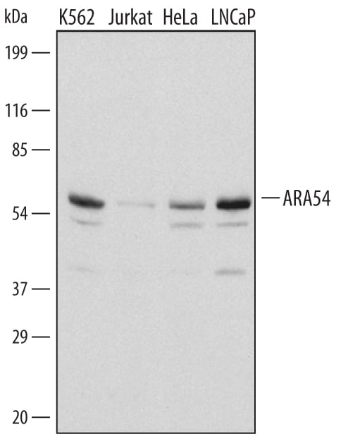 Detection of Human ARA54 antibody by Western Blot.