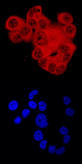 ARNT/HIF-1 beta  antibody in T47D Human Cell Line by Immunocytochemistry (ICC).
