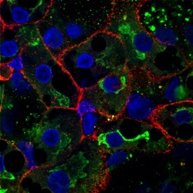 ASGR1/ASGPR1 antibody in BG01V Human Embryonic Stem Cells by Immunocytochemistry (ICC).