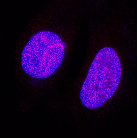 ATAD2 antibody in MCF-7 Human Cell Line by Immunocytochemistry (ICC).