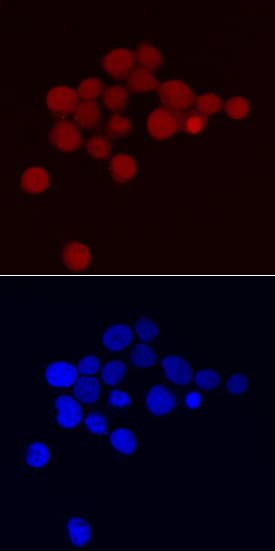 ATF4 antibody in Jurkat Human Cell Line by Immunocytochemistry (ICC).