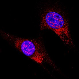 ATF6 antibody in A549 Human Cell Line by Immunocytochemistry (ICC).