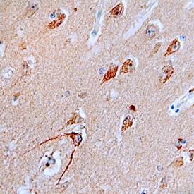 ATG7 antibody in Human Brain by Immunohistochemistry (IHC-P).