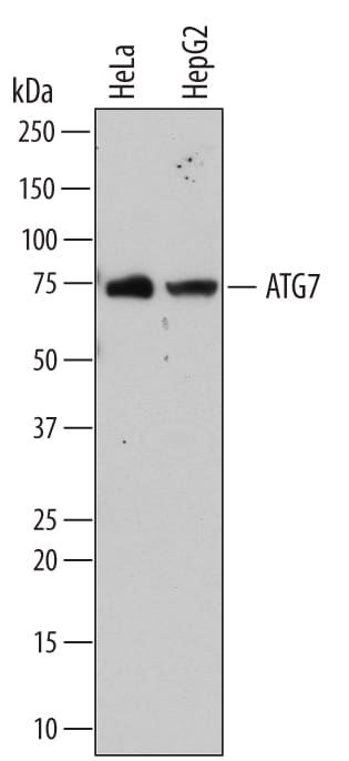 Detection of Human ATG7 antibody by Western Blot.