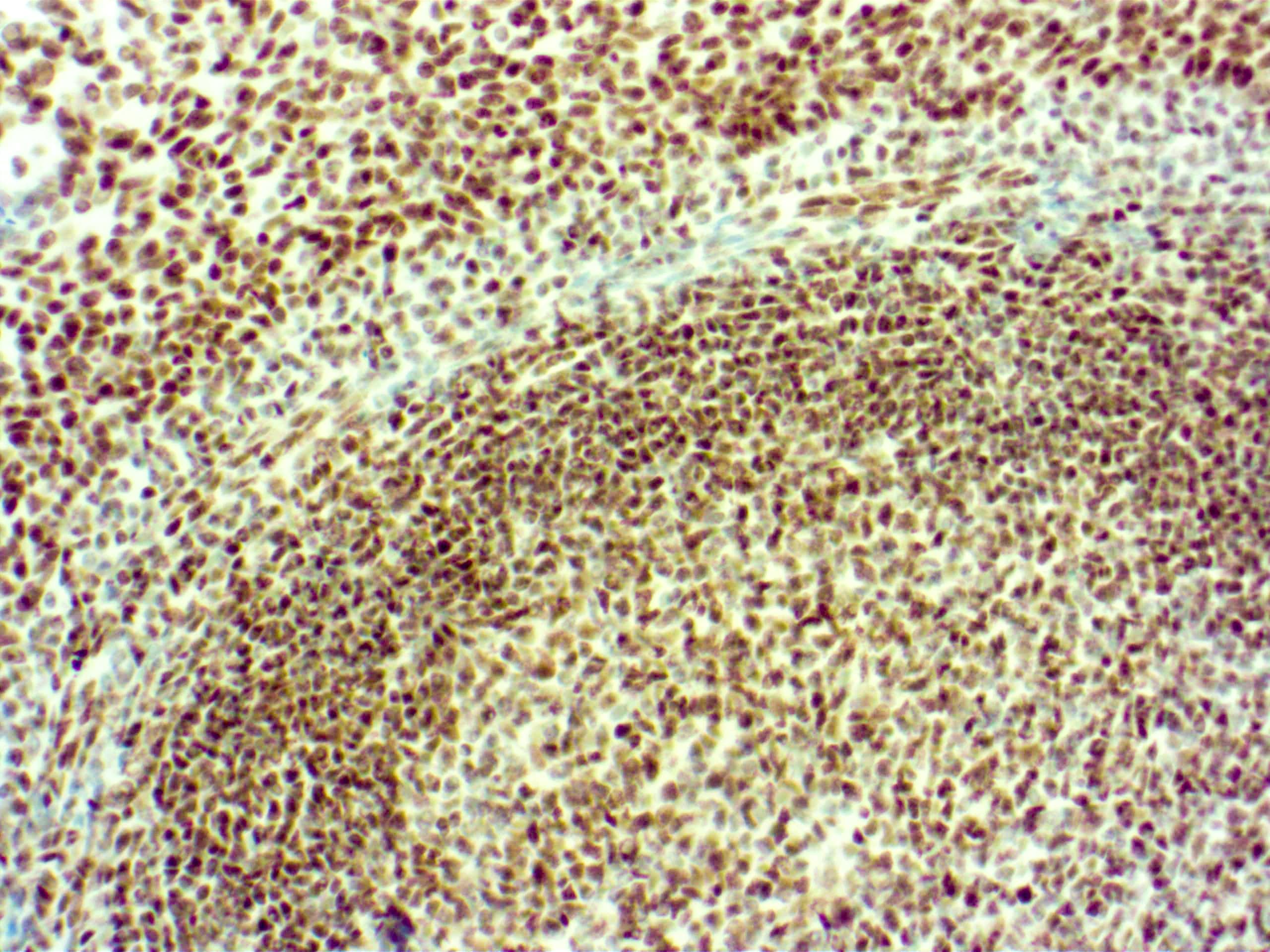 ATRX Antibody (D5)