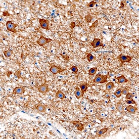 Acetylcholinesterase/ACHE antibody in Human Brain by Immunohistochemistry (IHC-P).