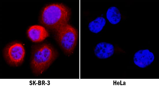 Activin A antibody in SK-BR-3 and HeLa Human Cell Lines by Immunocytochemistry (ICC).
