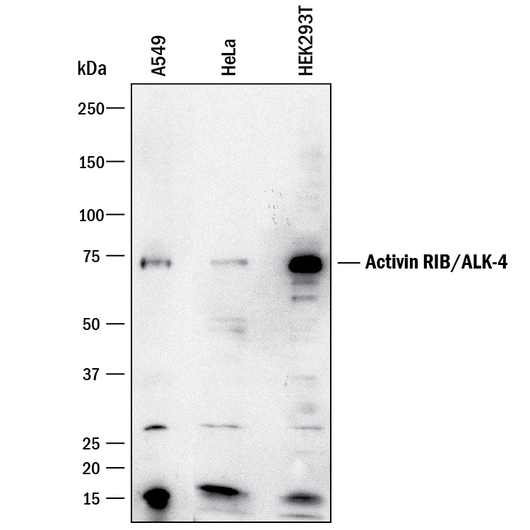 Detection of Human Activin RIB/ALK-4 antibody by Western Blot.