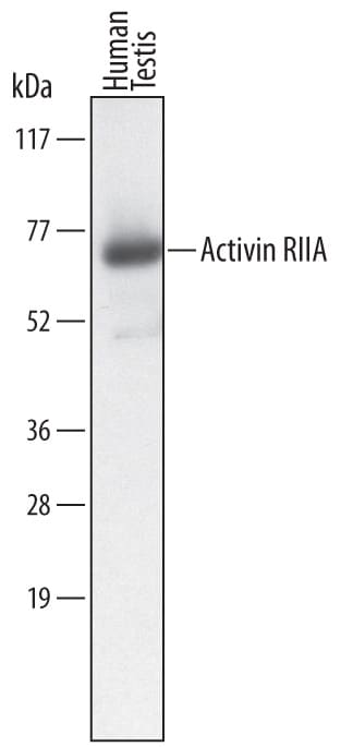 Detection of Human Activin RIIA antibody by Western Blot.