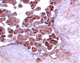 Activin RIIB antibody in Human Placenta by Immunohistochemistry (IHC-P).