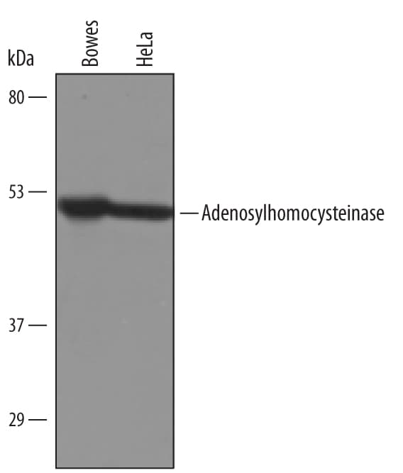 Detection of Human Adenosylhomocysteinase/AHCY antibody by Western Blot.