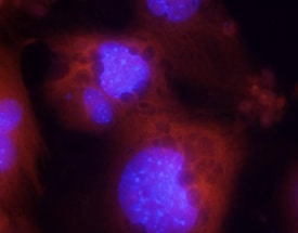 Adiponectin/Acrp30 antibody in ST-2 mouse bone marrow-derived stromal cell line differentiated to adipocytes by Immunocytochemistry (ICC).