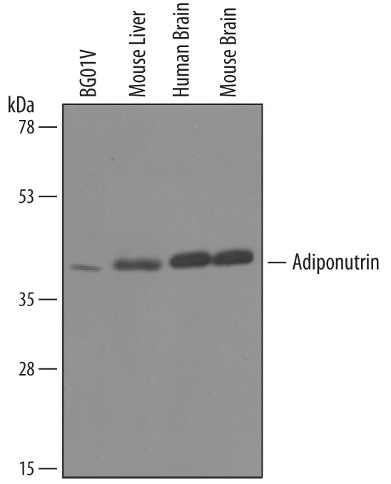 Detection of Human and Mouse Adiponutrin/PNPLA3 antibody by Western Blot.
