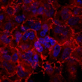 Afadin/AF-6 antibody in BEAS2B Human Cell Line by Immunocytochemistry (ICC).