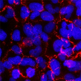 Afadin/AF-6 antibody in BEAS2B Human Cell Line by Immunocytochemistry (ICC).
