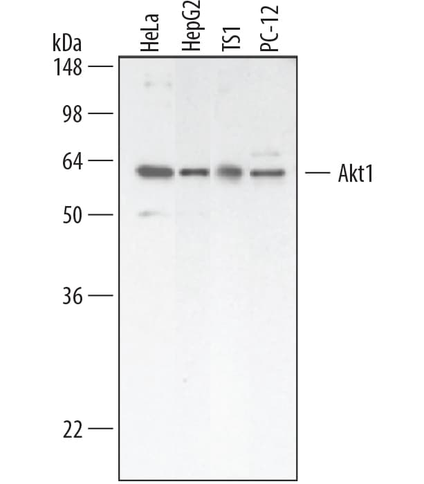 Detection of Human, Mouse, and Rat Akt1 antibody by Western Blot.