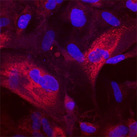 Phospho-Akt1 (T308) antibody in CCD-1070Sk Human Cell Line by Immunocytochemistry (ICC).