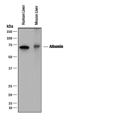 Detection of Human and Mouse Serum Albumin antibody by Western Blot.