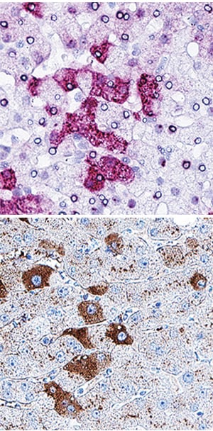 Serum Albumin antibody in Human Liver Using Dual RNAscope®ISH and IHC.