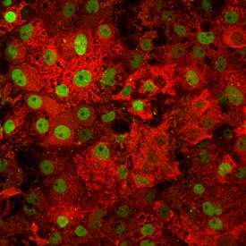 Albumin antibody in Hepatocytes Derived from Human Embryonic Stem Cells by Immunocytochemistry (ICC).