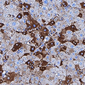 Albumin antibody in Human Liver by Immunohistochemistry (IHC-P).