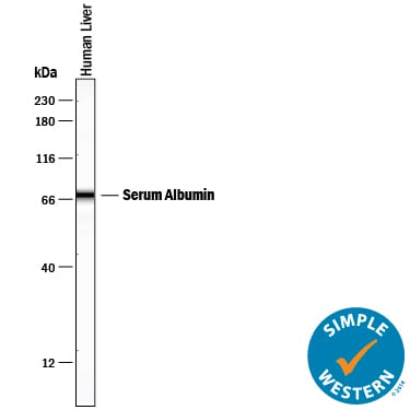 Detection of Human Albumin antibody by Simple WesternTM.